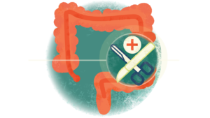 Ulcerative Colitis Treatment